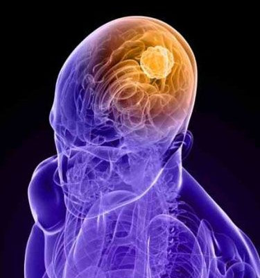 Εξάσκησε το μυαλό σου