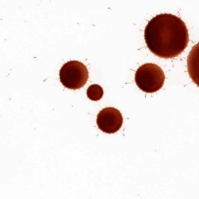 Πώς να καθαρίσετε λεκέ από αίμα