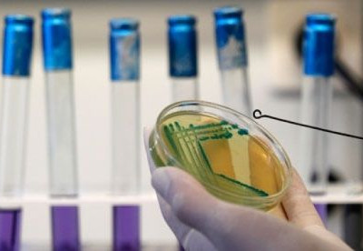 Σπόροι από την Αίγυπτο η «πηγή» της επιδημίας E.coli;