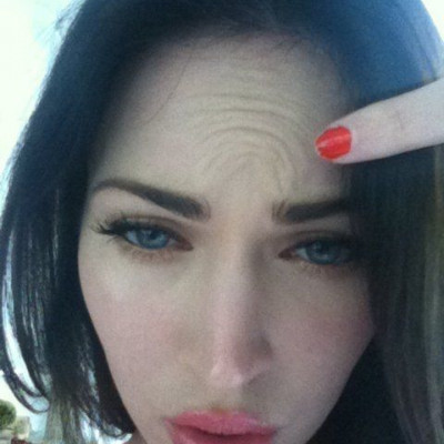 Μια φωτογραφική ιστορία botox από την Megan Fox