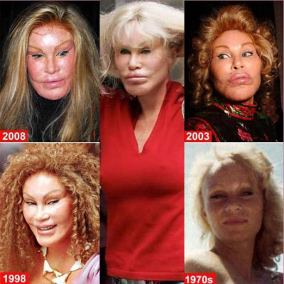 Βασίλισσες των πλαστικών: Jocelyn Wildenstein