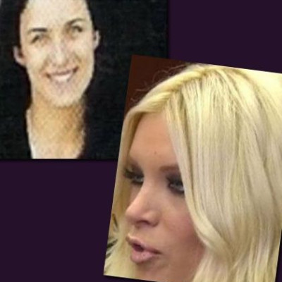 Κατερίνα Καινούργιου: «Θα ήταν ψέμα να πω ότι δεν έχω πειράξει τίποτα πάνω μου»