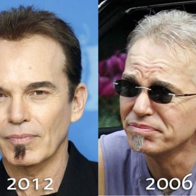 O Billy Bob Thornton μοιάζει με κέρινο ομοίωμα από το πολύ botox