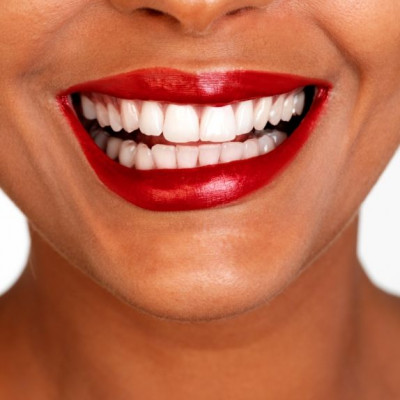 Τι χρώμα είναι το χαμόγελό σας;