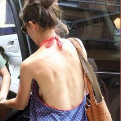 Katie Holmes: Σοκαριστικό θέαμα… πιο αδύνατη από ποτέ!