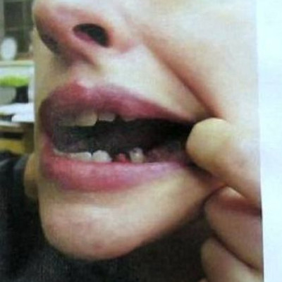 Σταρ του Χόλιγουντ επιδεικνύει τα... σάπια δόντια της!