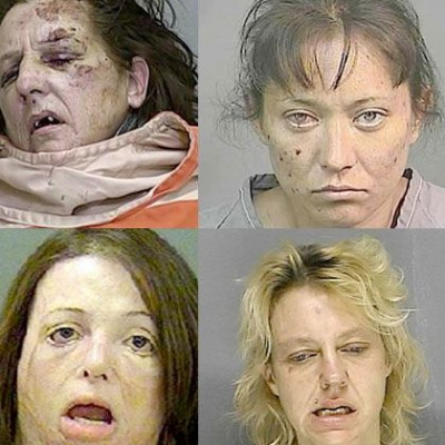 Σοκ! Διαφημιστική καμπάνια δείχνει την τρομακτική μετάλλαξη όσων κάνουν χρήση μεθαμφεταμίνης (photos)