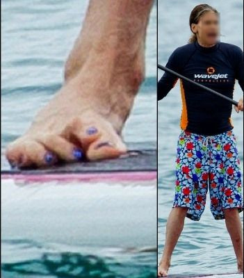 Δείτε σε ποιο rock star ανήκουν αυτά τα παραμορφωμένα δάχτυλα ποδιών;