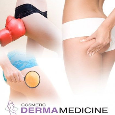 Κερδίστε 5 συνεδρίες cavitation για την καταπολέμηση της κυτταρίτιδας από την Cosmetic Derma Medicine