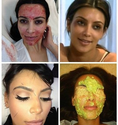 Οι τρομακτικές φωτογραφίες της Kim Kardashian!