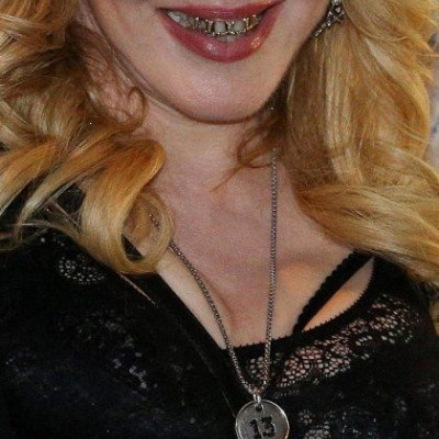 Χαμόγελο που… τρομάζει: Ποια ζάμπλουτη star γέμισε το στόμα της χρυσάφι;