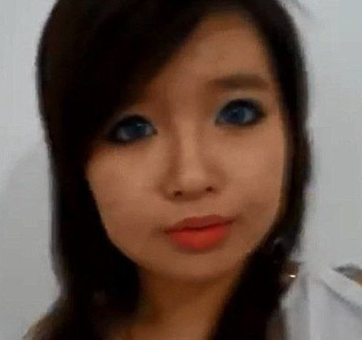 Μία 18χρονη με τεράστιο πρόβλημα ακμής, δίνει κουράγιο στα υπόλοιπα κορίτσια με τις συμβουλές της