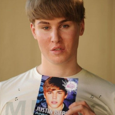 Γνωρίστε το fan του Justin Bieber που ξόδεψε $100.000 σε πλαστικές για να του μοιάσει (φωτός)
