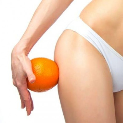 Κυτταρίτιδα: 8 μύθοι που καταρρίπτονται