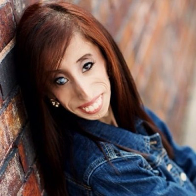 Η πιο «άσχημη γυναίκα στον κόσμο» είναι και η πιο όμορφη:Ακούστε τι έχει να πει! (video)