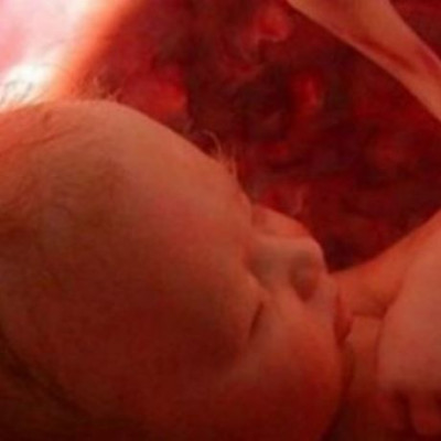 Έτσι περνούν την ώρα τους τα μωρά μέσα στην κοιλιά μας!