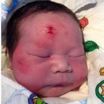 Μωρό γεννήθηκε λίγη ώρα αφότου η μητέρα του σκοτώθηκε σε τροχαίο