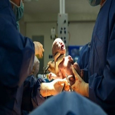 Καισαρική τομή: Πότε είναι αναγκαίο να γίνει