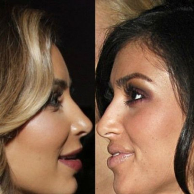 «Δεν έχω κάνει πλαστική στην μύτη», λέει η Kim και τα ξένα Μέσα την κάνουν ρεζίλι!