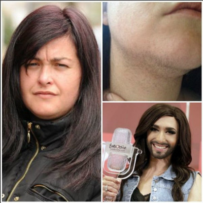 Απίστευτο: 32χρονη γυναίκα ξυρίζεται στο πρόσωπο 2 φορές την ημέρα