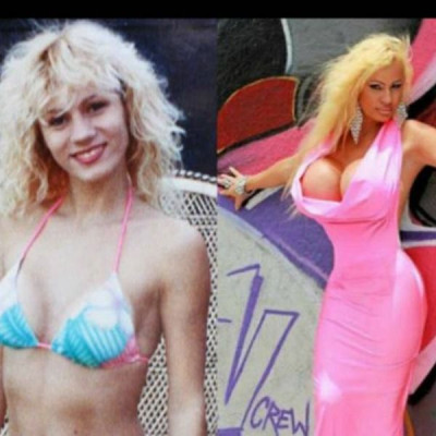 Έκανε την 36η πλαστική επέμβαση για να μοιάσει στην Barbie! (βίντεο)