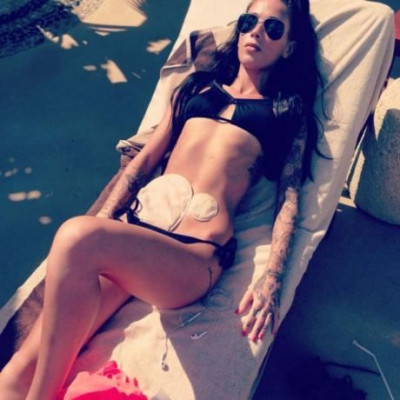 Η selfie που ενέπνευσε χιλιάδες ασθενείς της νόσου του Chrohn να δείξουν τις σακούλες τους