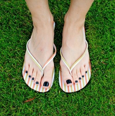 Μύκητες στα πόδια; Οι φυσικές συνταγές που θα σας βοηθήσουν να απαλλαγείτε γρήγορα