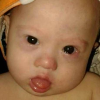 Τραγικό: Εγκατέλειψαν μωρό που είχε σύνδρομο Down (pics)