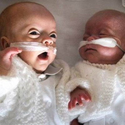 Ιταλία: Γεννήθηκαν τα «δίδυμα με τέσσερις γονείς»