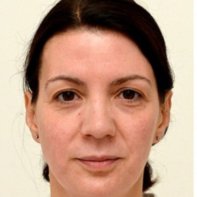 Έπινε 3 λίτρα νερό τη μέρα επί ένα μήνα και το πρόσωπό της άλλαξε εκπληκτικά! Δείτε το