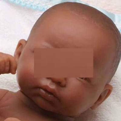 Λευκή γυναίκα που γέννησε μαύρο μωρό μηνύει τράπεζα σπέρματος