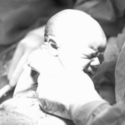 Καισαρική: Δείτε τη γέννα καρέ καρέ μέσα από ένα εκπληκτικό φωτογραφικό άλμπουμ