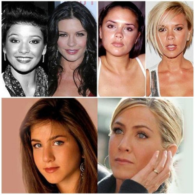 Ουπς: 16 stars πριν και μετά τις πλαστικές επεμβάσεις!