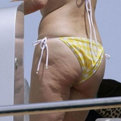 Πες αντίο στην κυτταρίτιδα με αυτό το προϊόν που έχεις στο σπίτι σου!