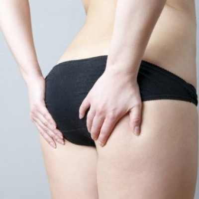 Κυτταρίτιδα: 3 στοχευμένες ασκήσεις για να την εξαφανίσετε