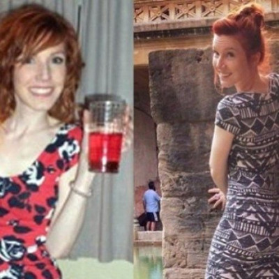 Δεκαεξάχρονη ζούσε με 10 θερμίδες την ημέρα