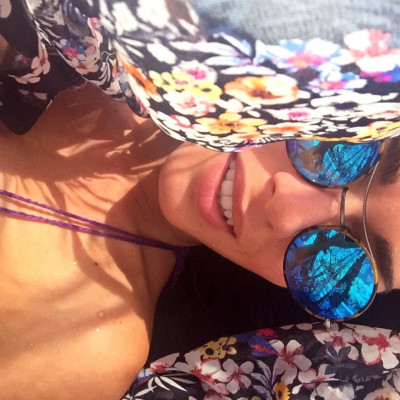 Η πιο εύκολη -σχεδόν στιγμιαία- λοσιόν για μετά τον ήλιο, σπιτική και... στα μέτρα μας!