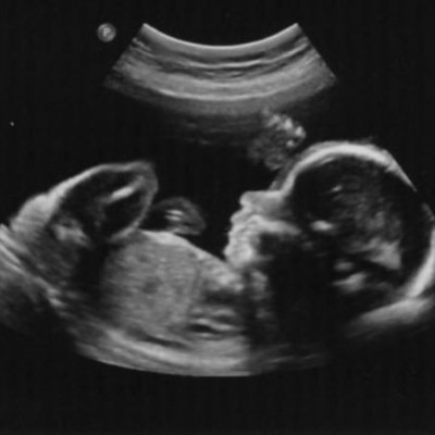 «Μη με σκοτώσεις μαμά», ένα συγκλονιστικό κείμενο που όλοι πρέπει να διαβάσουν!