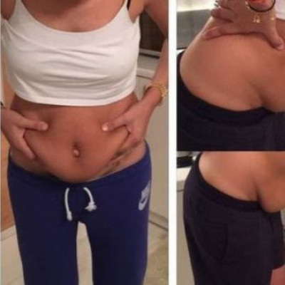 Ελληνίδα μαμά μας δείχνει την κοιλιά της μετά τη γέννηση του τέταρτου παιδιού της!(εικόνα)