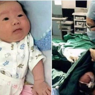 Νοσοκόμα θηλάζει μωρό που δεν σταματούσε το κλάμα πριν το χειρουργείο (εικόνα)