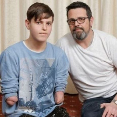 Έφηβος με ακρωτηριασμένα άκρα κλήθηκε να αποδείξει την αναπηρία του! (φωτό)