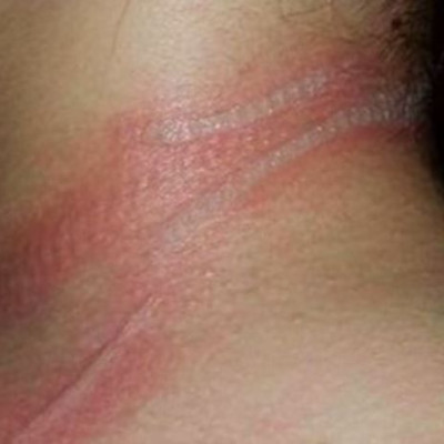 Η κόρη της ούρλιαζε από πόνο & εκείνη δεν ήξερε γιατί.Τώρα προειδοποιεί τους άλλους γονείς