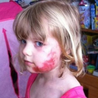 Δεν πάει ο νους σας από τι τραυματίστηκε το 4χρονο κοριτσάκι (φωτό)