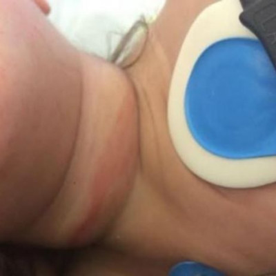 «Η κόρη μου στραγγαλίστηκε στον παιδικό σταθμό!»-Η εξομολόγηση μιας μαμάς που σοκάρει