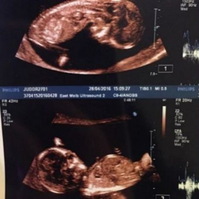 Διάσημη παρουσιάστρια είναι έγκυος και περιμένει δίδυμα!