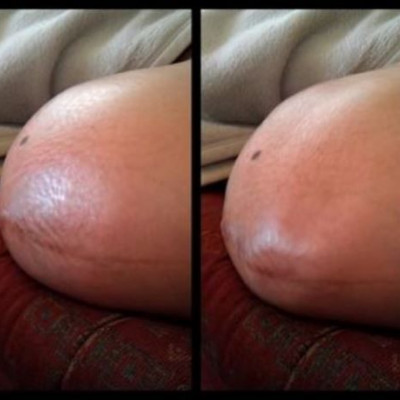 Δίδυμα «μάχονται» στην κοιλιά της μαμάς τους! Το βίντεο που κάνει θραύση