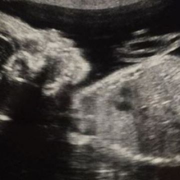 Έμαθαν το φύλο του μωρού τους και ανακοίνωσαν το όνομα μαζί με τον υπέρηχο