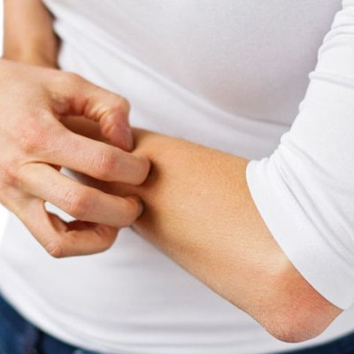 Έκζεμα: 6 πράγματα που δείχνει για την υγεία σας