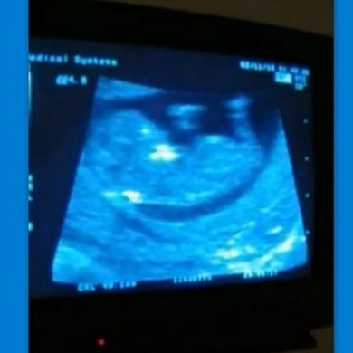 Ελληνίδα αθλήτρια  πρώτης γραμμής ανακοίνωσε την εγκυμοσύνη της με το πρώτο υπερηχογράφημα!