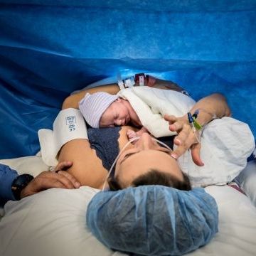 3 αλήθειες για τις μαμάδες που έχουν γεννήσει με καισαρική τομή